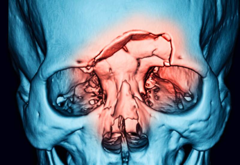 facial-trauma-treatment-sri-hospitals-1