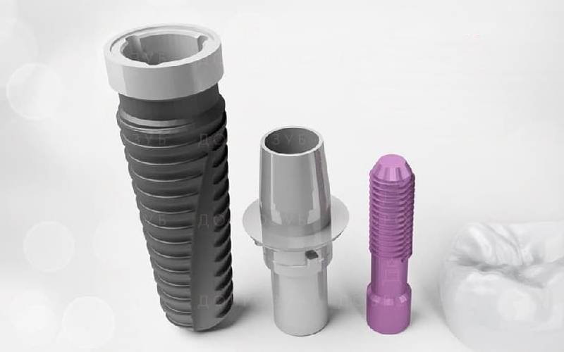 nobel-biocare-implants