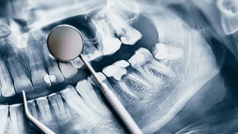 oral-faciomaxillary-sri-hospitals